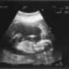 Sandman och Tina p ultraljud Sandman och Tina p ultraljud